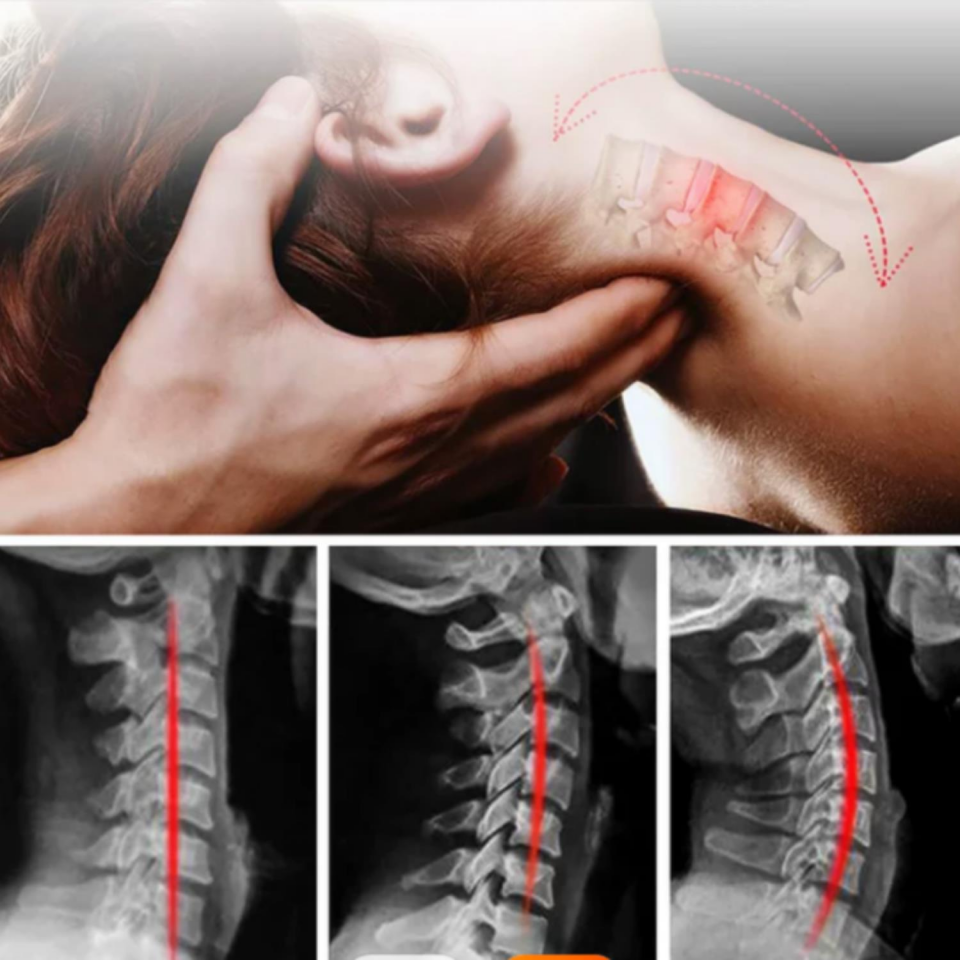 Boyun Masaj Ve Traksiyon Cihazı