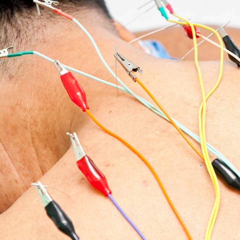 Elektro Akupunktur Cihazı 6 Kanallı Tens Cihazı