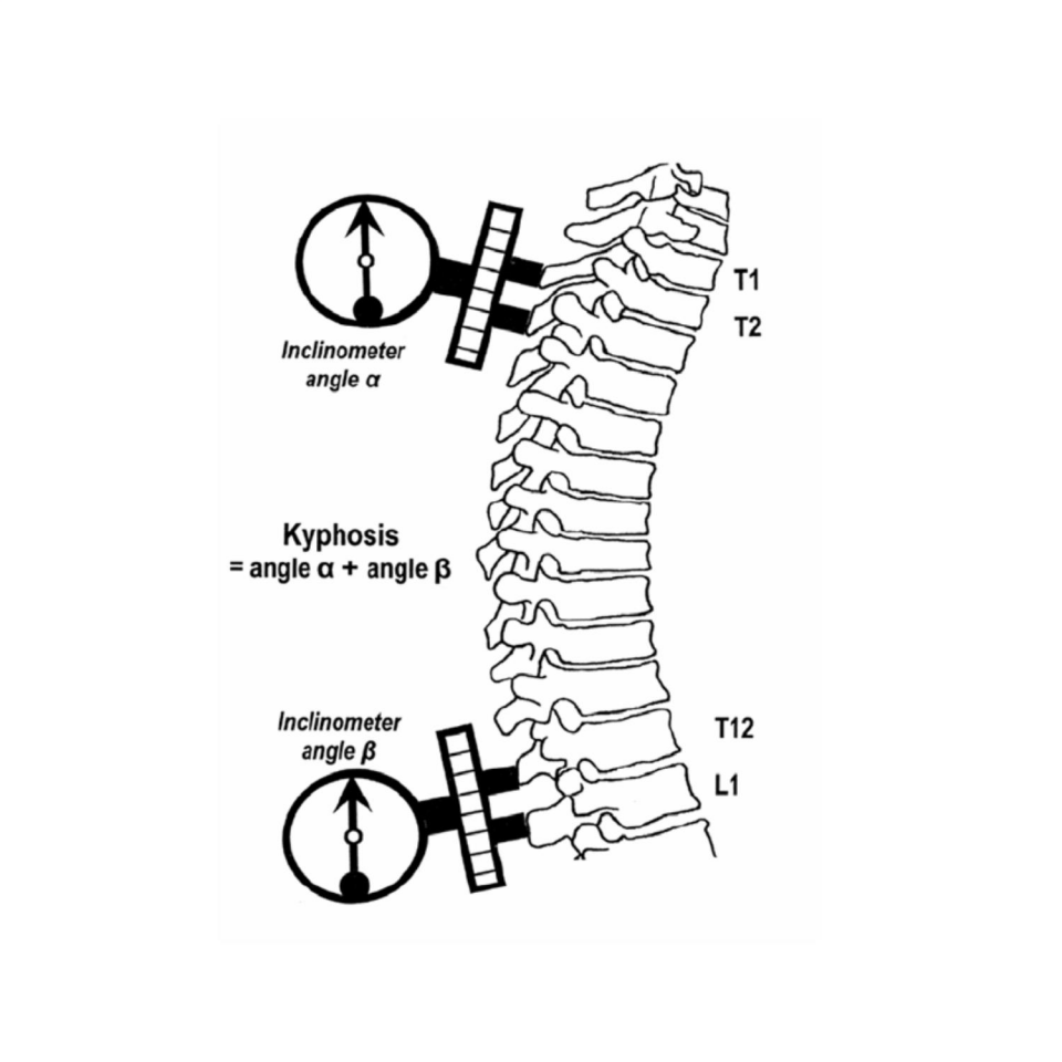 İnclinometre Lordoz ve Kifoz Ölçüm Metre