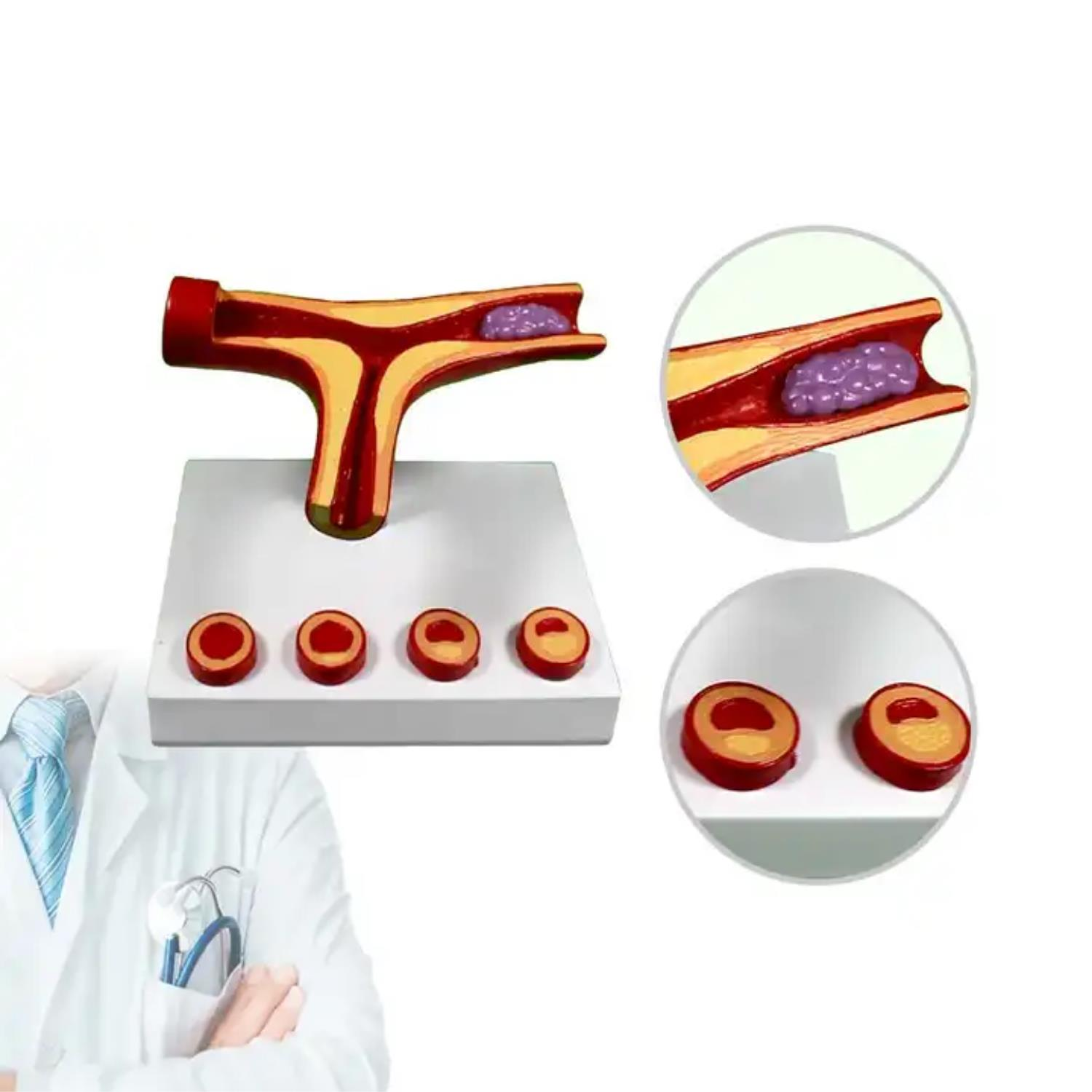 Damar Maketi Tıp Eğitim Maketi Model 46